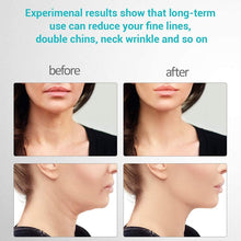 Load image into Gallery viewer, AuraTight™ - Neck &amp; Facial Lifting Device
